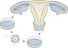 Photo for In Vitro Fertilisation