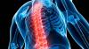 Photo for How to Prevent Osteoporosis.