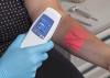 Photo for Vein Illumination Devices Market and Industry Development Research Report 2015 to 2022