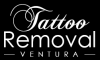 Photo for Tattoo Removal Ventura
