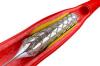 Photo for Vascular Stents Market Volume Forecast and Value Chain Analysis 2016-2020