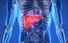 Photo for Nonalcoholic Steatohepatitis Market - Global Industry Perspective, Comprehensive Analysis and Forecast, 2014 – 2020