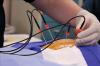 Photo for Global Radiofrequency Ablation Market is Expected to Reach Around USD 696.5 million by 2020