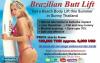 Photo for What issues does the Brazilian Lift address?