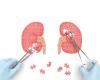 Photo for Nephrology and Urology Devices Market witness rapid growth due to High Incidence of Kidney-related Diseases