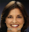 Photo for Cosmetic dentist, teeth whitening, Tooth bleaching & extraction