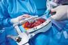 Photo for Global Interventional Cardiology Consumption 2016 Market Forecast, Report & Analysis