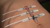 Photo for Emerging Trends Of Global Surgical Incision Closure Devices Market, Size & Analysis 2016