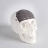 Photo for United States Craniomaxillofacial Implants Industry Growth & Forecast 2016