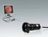Photo for Global ENT And Bronchoscopy Market Size, News & Demand 2016