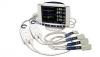Photo for United States Cardiovascular Diagnostic Device Industry Growth & Strategies 2016
