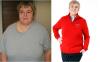 Photo for Gastric Sleeve in Mexico - Good Service weight Loss