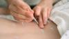 Photo for Take services of Traditional Chinese Medicine Practitioners