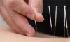 Photo for Advantage of Traditional Chinese Medicine Practitioners