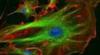 Photo for Human Cardiomyocytes