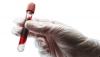 Photo for In-Vitro Cancer Diagnostics Market -Global Size, Share, Trends Analysis and Forecast, 2015 – 2021