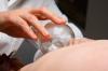 Photo for Chinese cupping therapy can Remove Harmful Substance