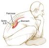 Photo for Chronic Pancreatitis Pain Market: Industry Perspective, Comprehensive Analysis and Forecast, 2014 – 2021