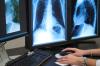Photo for Fastest growing sectors in Global Radiology PACS Market 2016