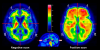 Photo for PET Imaging in Japan Profits up in New Regions
