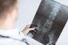 Photo for Benefits of Spinal Decompression - PremierMedGroup