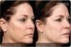Photo for Wipe Away Wrinkles & Dark Spots with Image Revive Serum!
