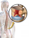 Photo for Multiple Myeloma Therapeutics Market: Major Advancements in the -- Technologies; Global Industry Analysis 2023
