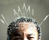 Photo for How to get service Through Acupuncturist vancouver