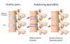 Photo for Know Some of the Treatment Options for Ankylosing Spondylitis Problem