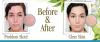 Photo for http://www.healthsupplementreview.com/clear-skin/