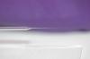 Photo for Global Pipette Tips Market Size and Forecast up, 2016: Reseach Beam