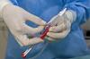 Photo for Fibrin Glue Market: By End-User, Application, Regional Segment Analysis, 2014 - 2020