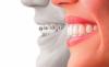 Photo for Cosmetic Implants Market Is Expected to Reach $10,708 Million, Globally by 2022