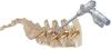Photo for Global Spine Surgery Devices Market Research Report 2016