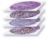 Photo for Global Digital Pathology Analytics Market 2016 Product Types,Sales,Price,Share and Growth 2021