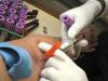 Photo for Global Blood Collection Systems Market 2016 by Manufacturers, Regions, Growth, Trends, Forecast to 2021