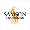 Photo for Samson Hair Restoration