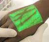 Photo for Global Vein Illuminator Market 2016 Industry Trends, Overview, Technology, Growth and Forecast to 2021