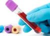 Photo for Global Blood Culture Tests Market 2016 Production, Price, Revenue, Cost, Gross Margin and Analysis by 2022