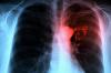 Photo for Global Nuclear Medicine Diagnostics Market 2016 Industry Growth, Capacity, Demand and Analysis by 2021