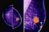 Photo for Global Breast Imaging Market 2016 Production, Price, Revenue, Cost, Gross Margin and Analysis by 2022
