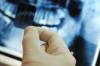Photo for Global Dental Digital X-ray Market 2016 Production, Price, Revenue, Cost, Gross Margin and Analysis by 2022