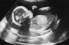 Photo for Global Ultrasound Market 2016 Production, Price, Revenue, Cost, Gross Margin and Analysis by 2022