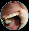 Photo for Looking for a Cost for Root Canal in New Jersey?