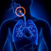 Photo for Global Polysomnography (PSG) Device Market 2016 Production, Trends, Supply, Demand and Industry Growth by 2021