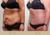 Photo for Special Confidence Gainer - Cosmetic Surgery South Wales