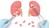 Photo for Global Urology Devices Market Dialysis, Urinary Stone, chronic kidney diseases, urinary incontinence- Forecast to 2027