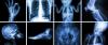 Photo for Medical/Diagnostic Imaging Market is Expected to Reach $45.0 Billion, Globally, by 2022
