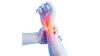 Photo for Neuropathic Pain Market Expected to be Valued US$ 8.3 Bn by 2024 End