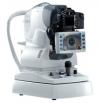 Photo for Global Fundus Cameras Market 2016 Production, Revenue, Price, Growth, Share 2021